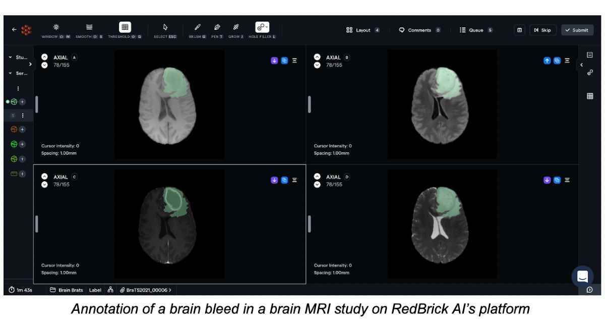 Redbrick AI