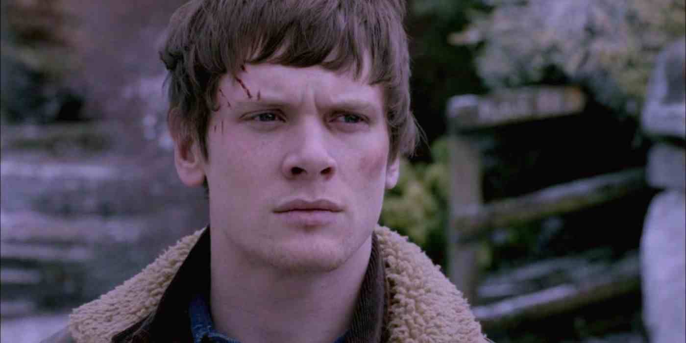 James Cook Derisinden Yaralandı